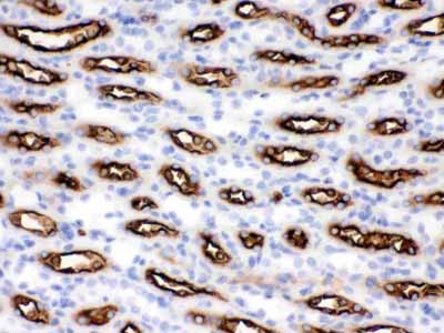 2 - Anti-SLC12A1 Picoband Antibody ABO12083