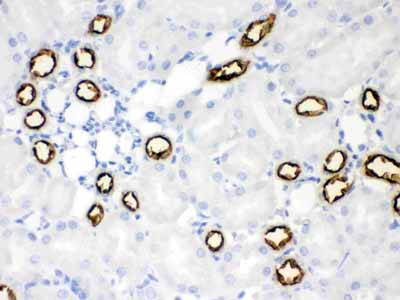 2 - Anti-SLC12A1 Picoband Antibody ABO12083