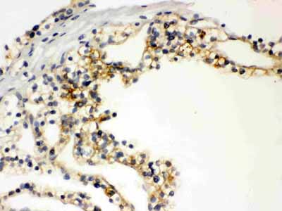 2 - Anti-SLC12A1 Picoband Antibody ABO12083