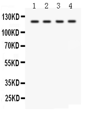 1 - Anti-SLC12A1 Picoband Antibody ABO12083