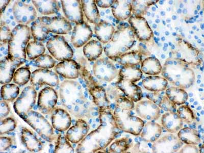 2 - Anti-SLC22A2 Picoband Antibody ABO12085