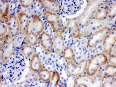 2 - Anti-SLC22A2 Picoband Antibody ABO12085