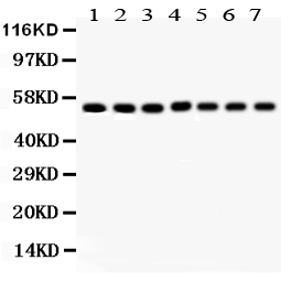 1 - Anti-SMAD1 Picoband Antibody ABO12086