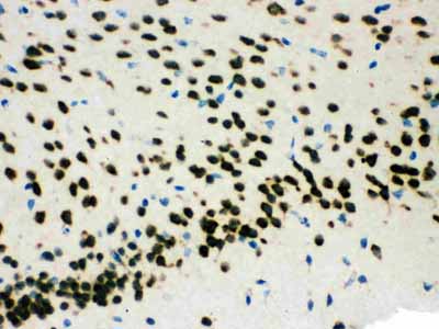 2 - Anti-SMN1/2 Picoband Antibody ABO12089