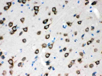 2 - Anti-SMN1/2 Picoband Antibody ABO12089