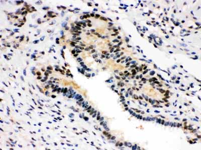 2 - Anti-SMN1/2 Picoband Antibody ABO12089