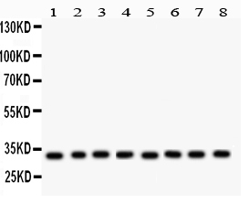 1 - Anti-SMN1/2 Picoband Antibody ABO12089