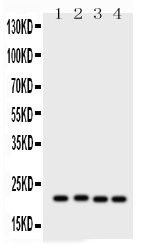 1 - Anti-SOCS2 Picoband Antibody ABO12091