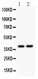 1 - Anti-SOX1 Picoband Antibody ABO12094