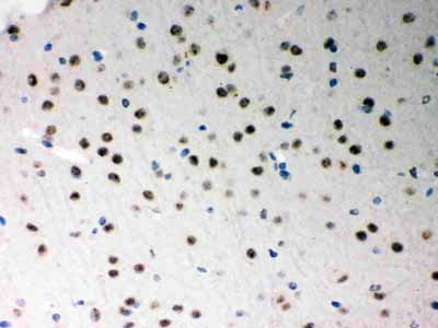 2 - Anti-SF2 Picoband Antibody ABO12095