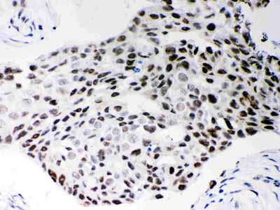 2 - Anti-SF2 Picoband Antibody ABO12095
