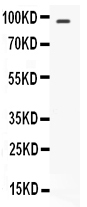 1 - Anti-STAT6 Picoband Antibody ABO12096