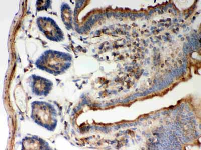 2 - Anti-STIM1 Picoband Antibody ABO12097