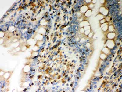 2 - Anti-STIM1 Picoband Antibody ABO12097