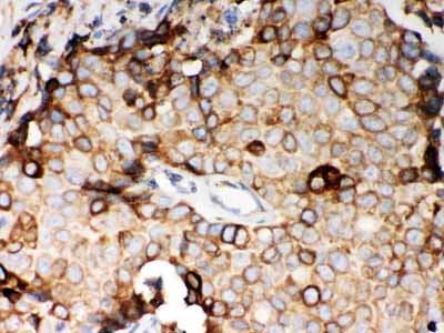 2 - Anti-STIM1 Picoband Antibody ABO12097