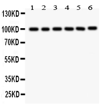 1 - Anti-STIM1 Picoband Antibody ABO12097