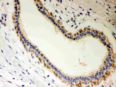 2 - Anti-Unrip Picoband Antibody ABO12098