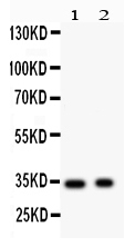 1 - Anti-Synaptophysin Picoband Antibody ABO12100