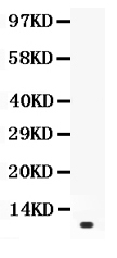 1 - Anti-Prolactin Picoband Antibody ABO12101