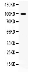 1 - Anti-RANK Picoband Antibody ABO12103