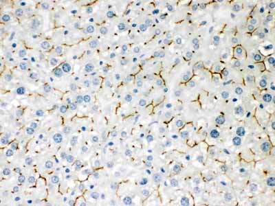 2 - Anti-ABCB11 Picoband Antibody ABO12104