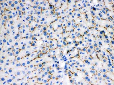 2 - Anti-ABCB11 Picoband Antibody ABO12104