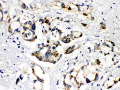 2 - Anti-ABCB11 Picoband Antibody ABO12104