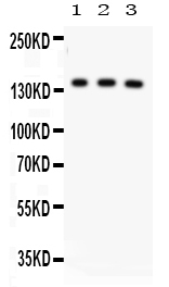 1 - Anti-ABCB11 Picoband Antibody ABO12104