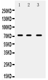 1 - Anti-ABCG5 Picoband Antibody ABO12105