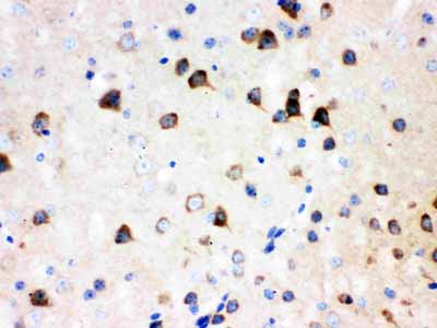 2 - Anti-ABI1 Picoband Antibody ABO12106
