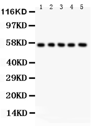 1 - Anti-ABI1 Picoband Antibody ABO12106