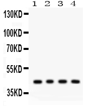 1 - Anti-ADIPOR1 Picoband Antibody ABO12108