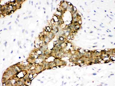 2 - Anti-Annexin A3 Picoband Antibody ABO12110