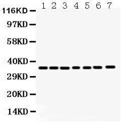 1 - Anti-Annexin A3 Picoband Antibody ABO12110