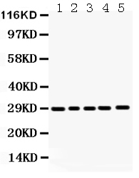 1 - Anti-APH1a Picoband Antibody ABO12111