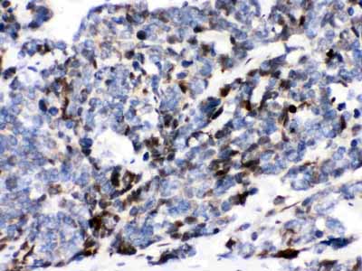 2 - Anti-Ataxin 1 Picoband Antibody ABO12112