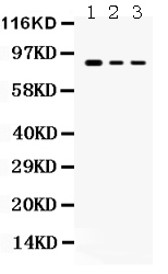1 - Anti-Ataxin 1 Picoband Antibody ABO12112