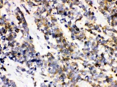 2 - Anti-Ataxin 3 Picoband Antibody ABO12113