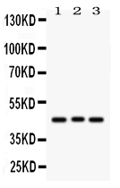 1 - Anti-Ataxin 3 Picoband Antibody ABO12113