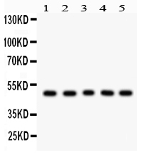 1 - Anti-Cyclin A2 Picoband Antibody ABO12114