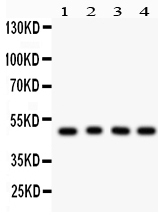 1 - Anti-CtBP1 Picoband Antibody ABO12115