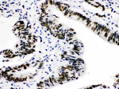 2 - Anti-CTBP2 Picoband Antibody ABO12116