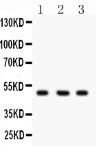 1 - Anti-CTBP2 Picoband Antibody ABO12116