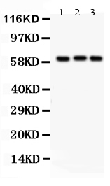 1 - Anti-Heparanase 1 Picoband Antibody ABO12117