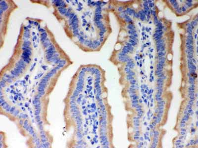 2 - Anti-ITPR3 Picoband Antibody ABO12118