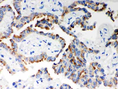 2 - Anti-ITPR3 Picoband Antibody ABO12118