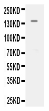 1 - Anti-VEGFR2/KDR Antibody ABO12119