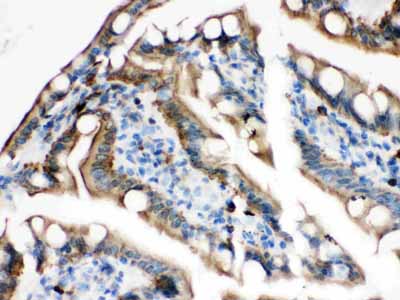 2 - Anti-Plectin Picoband Antibody ABO12120