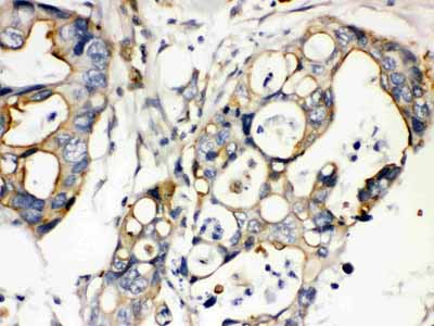 2 - Anti-Plectin Picoband Antibody ABO12120