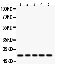 1 - Anti-Rac1 Picoband Antibody ABO12121
